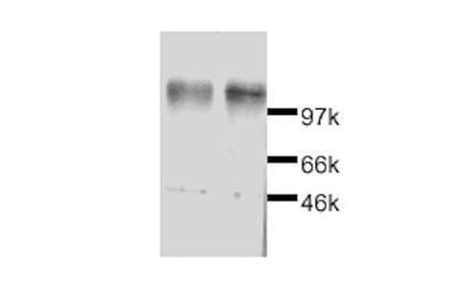 Leptin Receptor Antibody in Western Blot (WB)