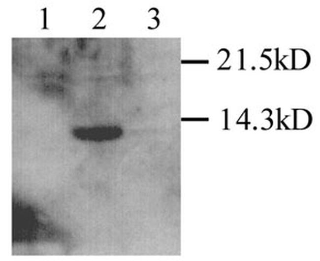 TYROBP Antibody in Western Blot (WB)