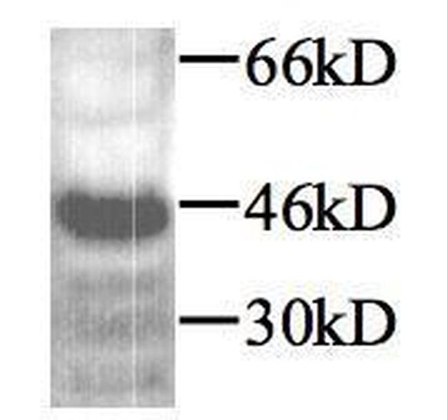 TGF beta-1 Antibody in Western Blot (WB)