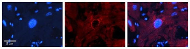 MBD2 Antibody in Immunohistochemistry (Paraffin) (IHC (P))