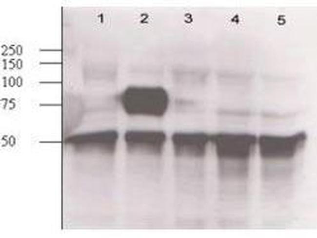 Angiopoietin 2 Antibody in Western Blot (WB)