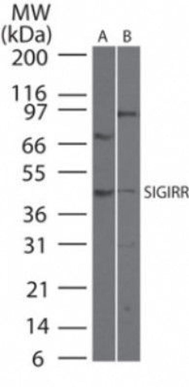 SIGIRR Antibody in Western Blot (WB)