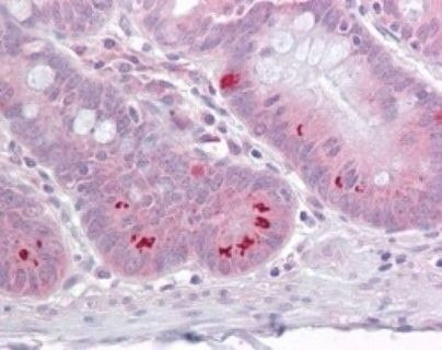 SETD7 Antibody in Immunohistochemistry (Paraffin) (IHC (P))