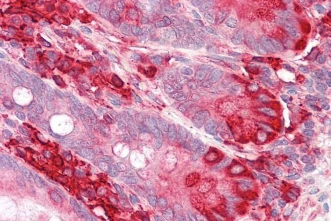 TXNDC5 Antibody in Immunohistochemistry (Paraffin) (IHC (P))