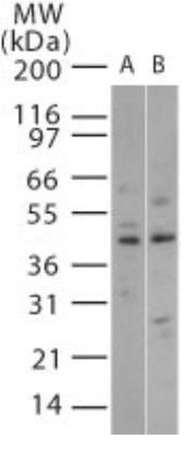 p38 MAPK beta Antibody in Western Blot (WB)