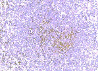 CCR8 Antibody in Immunohistochemistry (Paraffin) (IHC (P))