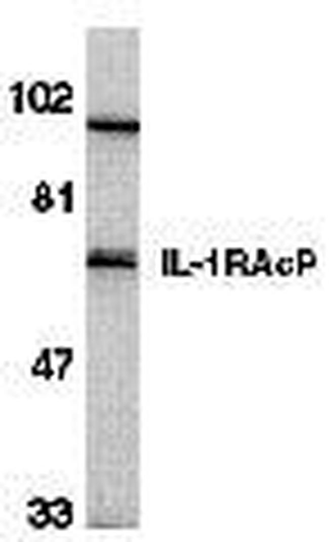 IL-1RAcP Antibody in Western Blot (WB)