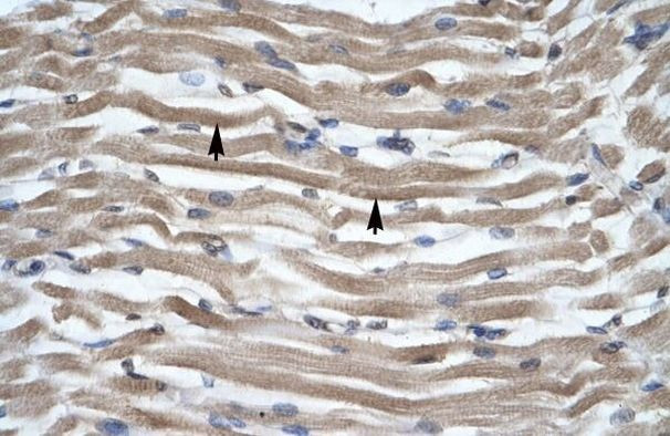 DLX2 Antibody in Immunohistochemistry (Paraffin) (IHC (P))