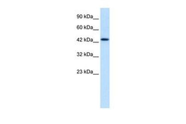 DLX2 Antibody in Western Blot (WB)