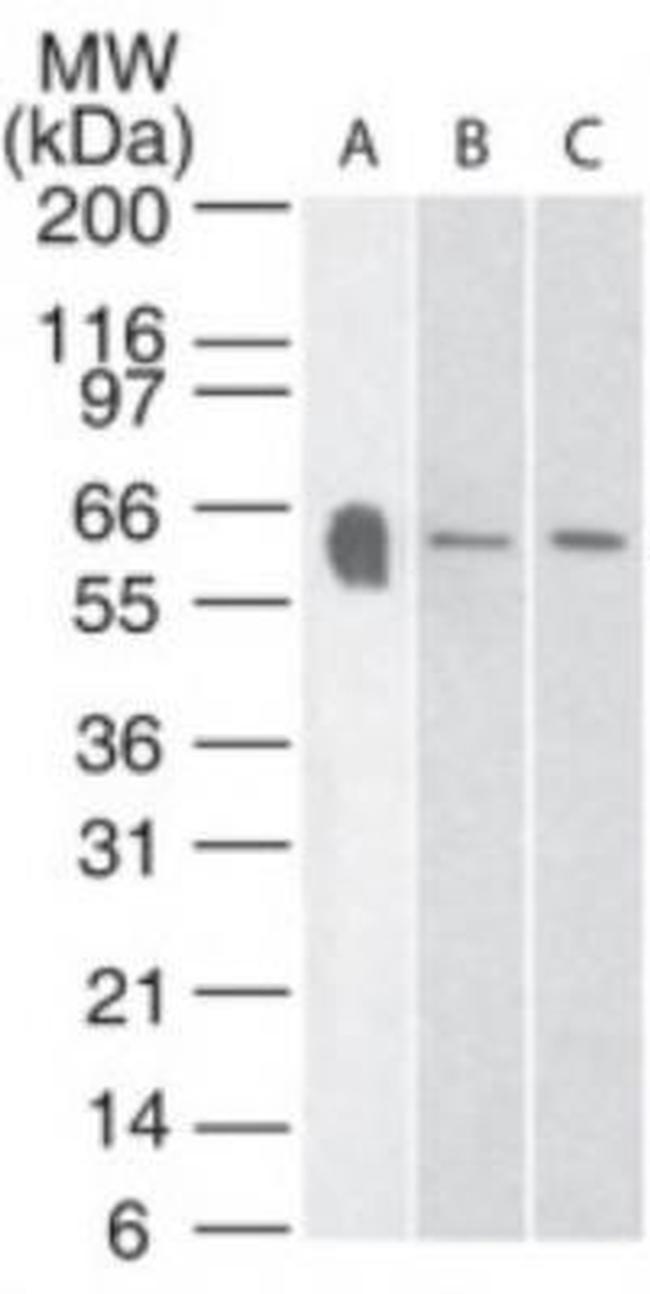 HTR3A Antibody in Western Blot (WB)