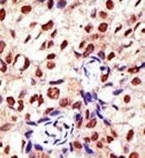 PRMT2 Antibody in Immunohistochemistry (Paraffin) (IHC (P))