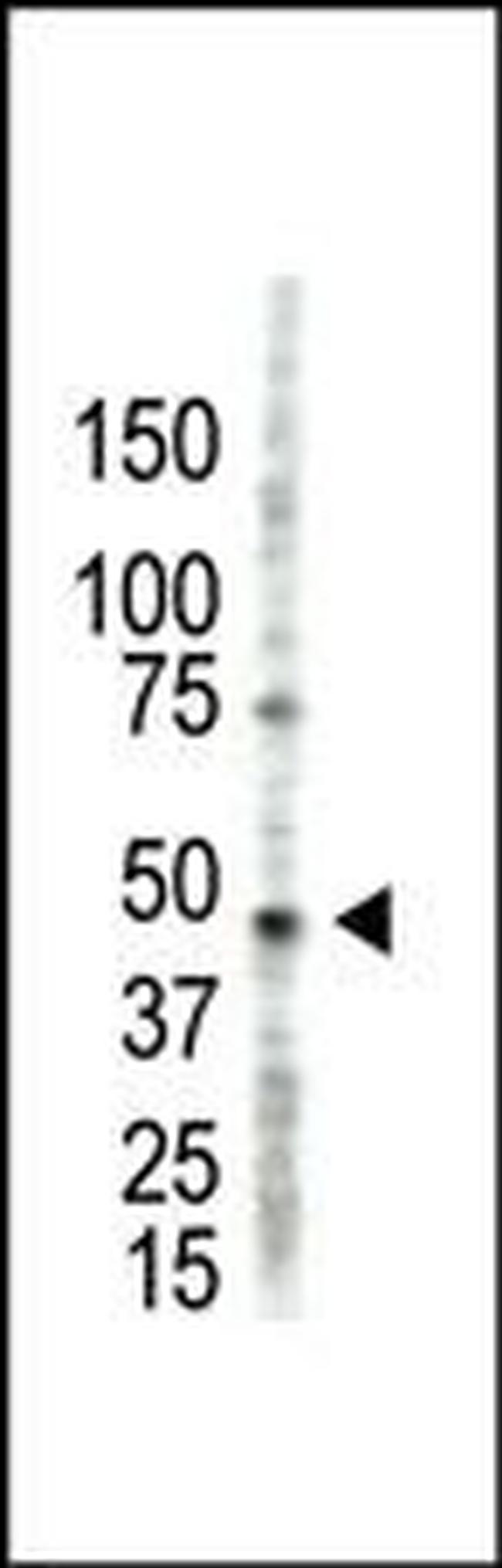 PRMT2 Antibody in Western Blot (WB)