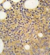 PRMT3 Antibody in Immunohistochemistry (Paraffin) (IHC (P))