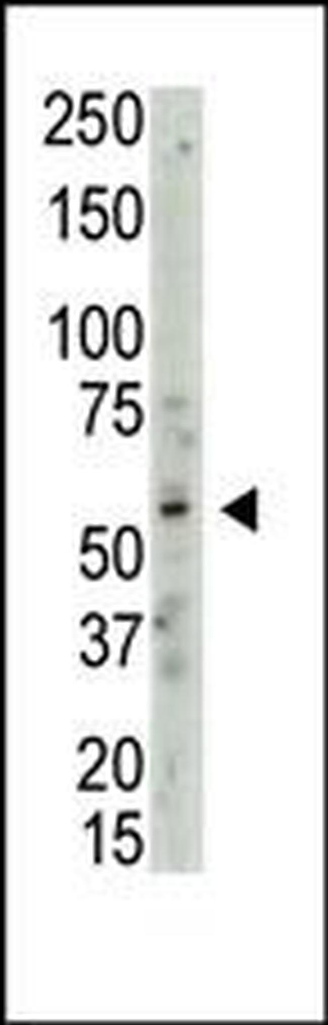 PRMT3 Antibody in Western Blot (WB)