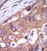 PKC mu Antibody in Immunohistochemistry (Paraffin) (IHC (P))