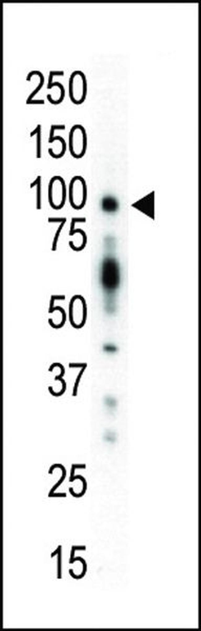 PKC mu Antibody in Western Blot (WB)