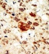 EphA1 Antibody in Immunohistochemistry (Paraffin) (IHC (P))