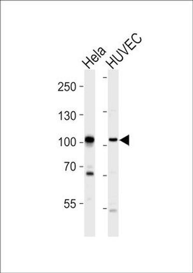 EphA4 Antibody in Western Blot (WB)