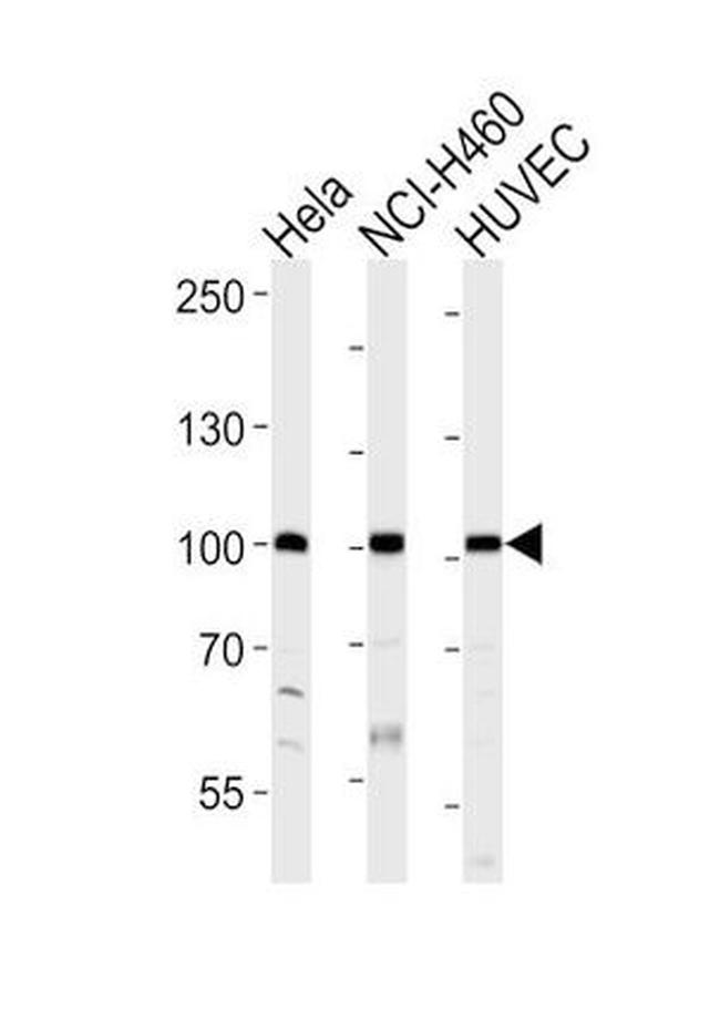 EphA4 Antibody in Western Blot (WB)