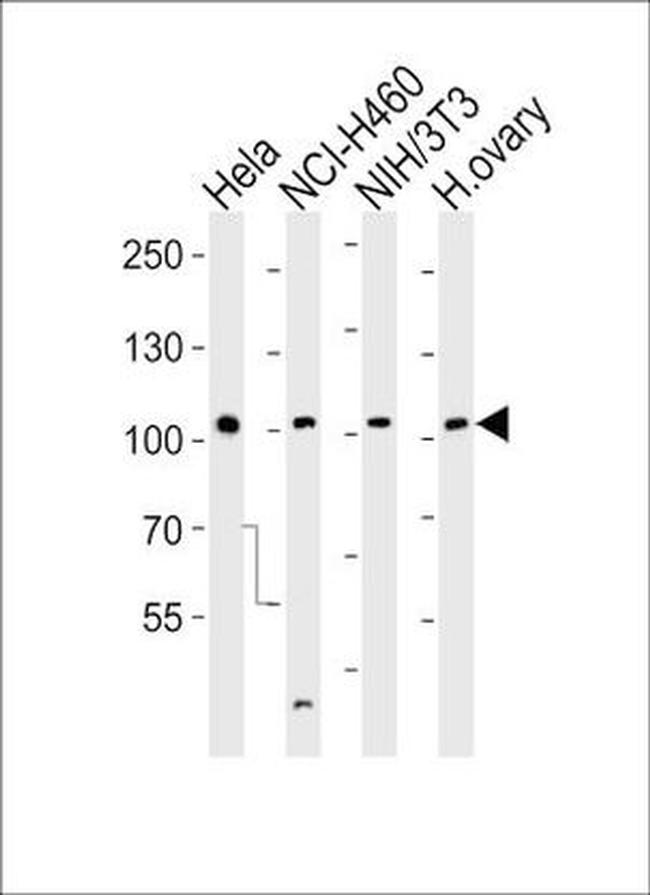 EphA4 Antibody in Western Blot (WB)