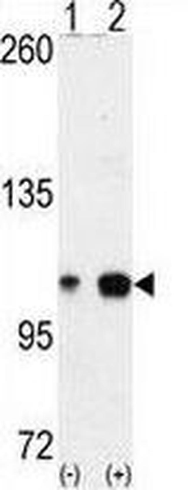 EphA4 Antibody in Western Blot (WB)