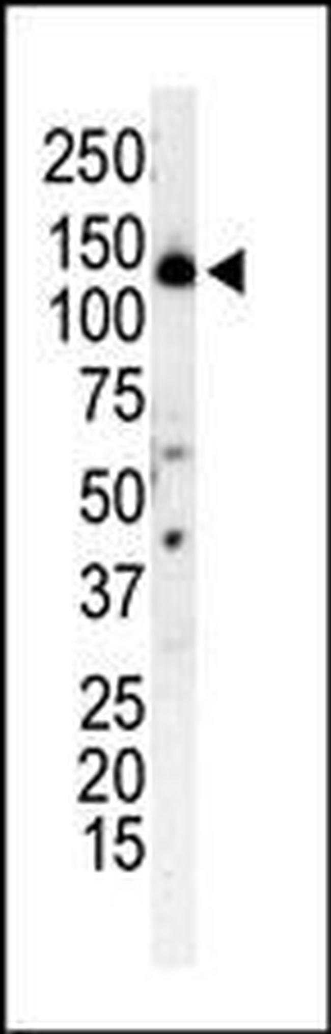 PIK3R4 Antibody in Western Blot (WB)