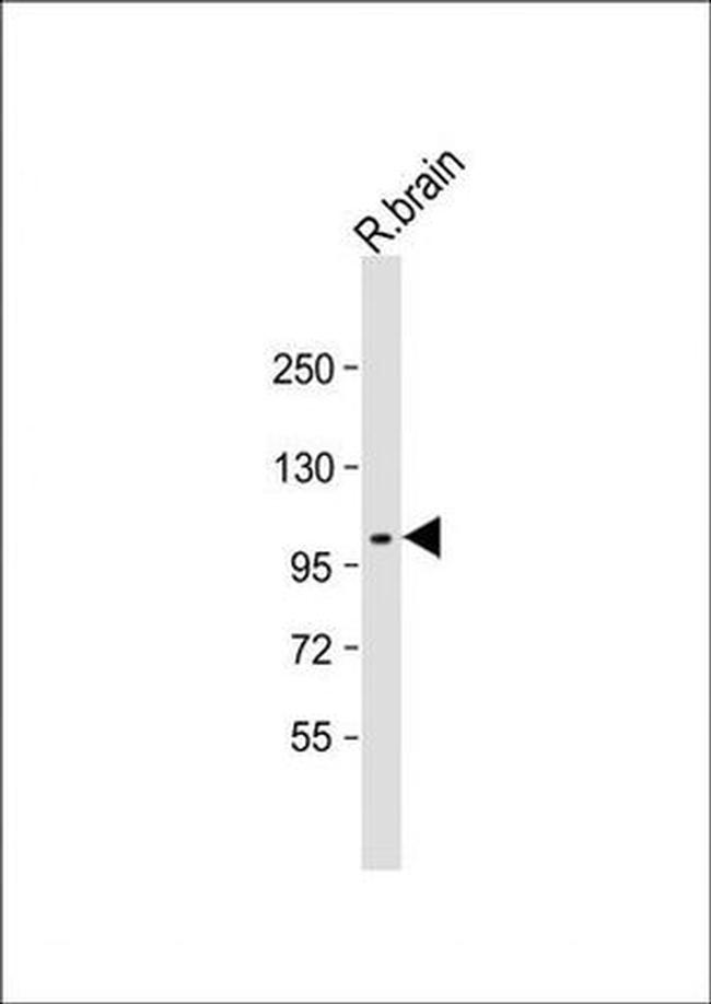 MCK10 Antibody in Western Blot (WB)