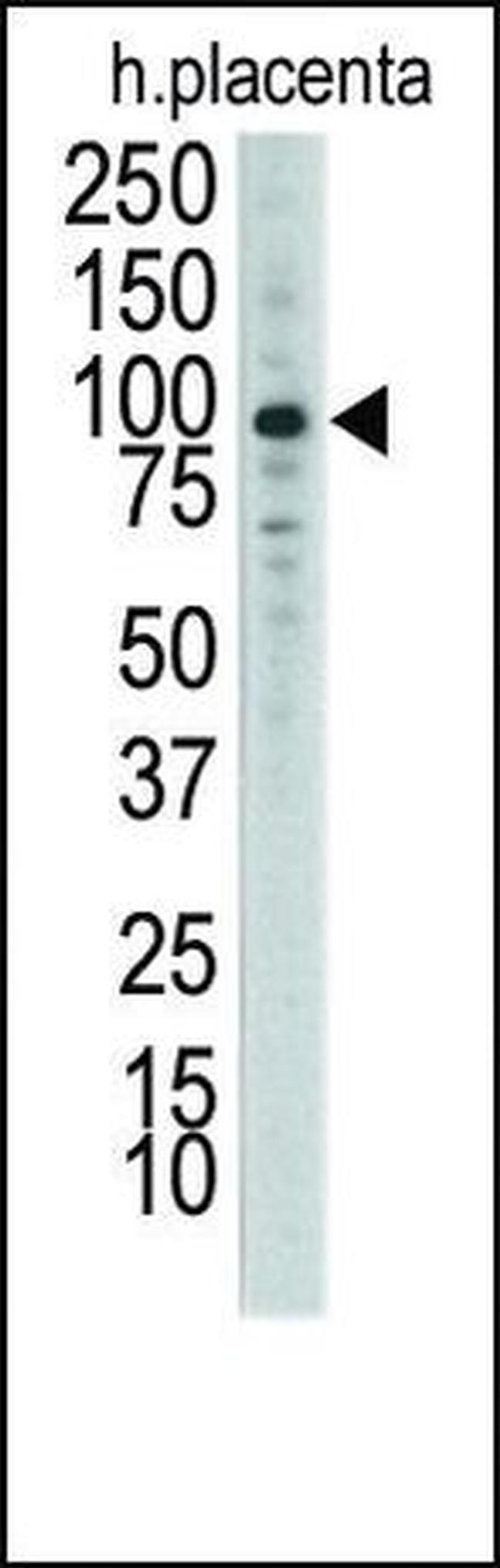 MCK10 Antibody in Western Blot (WB)