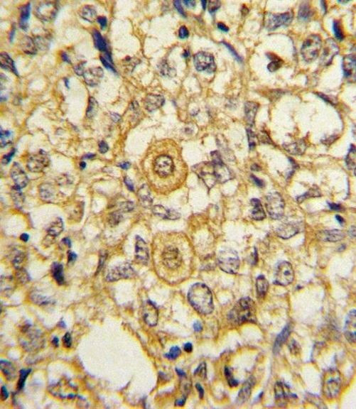 PDGFRB Antibody in Immunohistochemistry (Paraffin) (IHC (P))