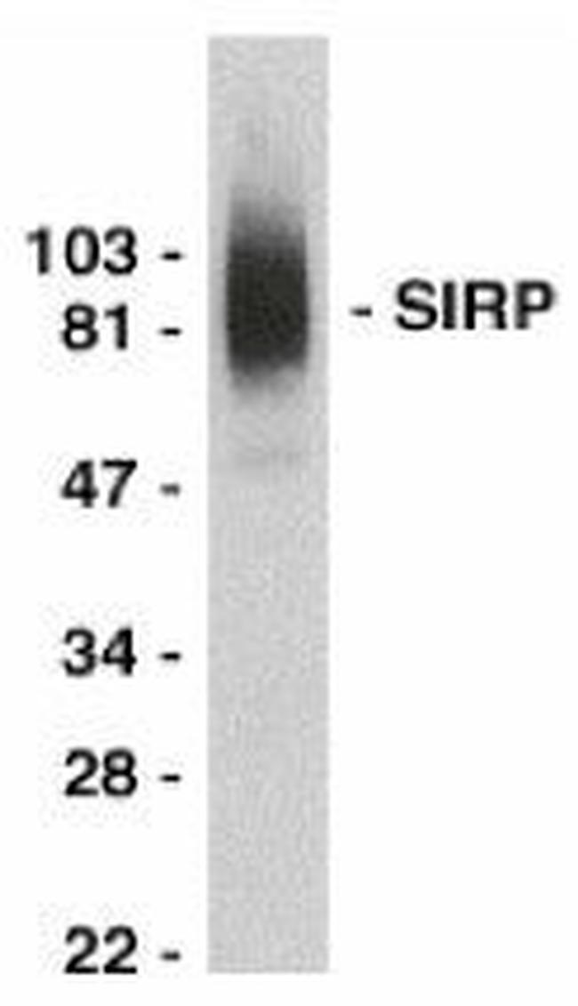 SIRP alpha Antibody in Western Blot (WB)