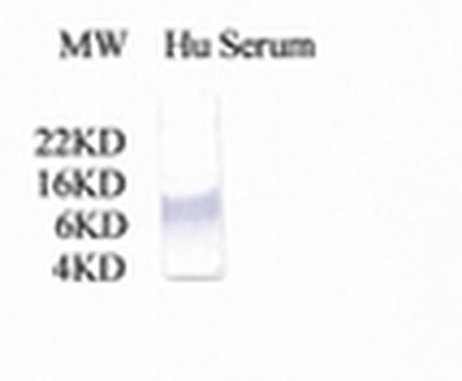 Complement C3a Antibody in Western Blot (WB)