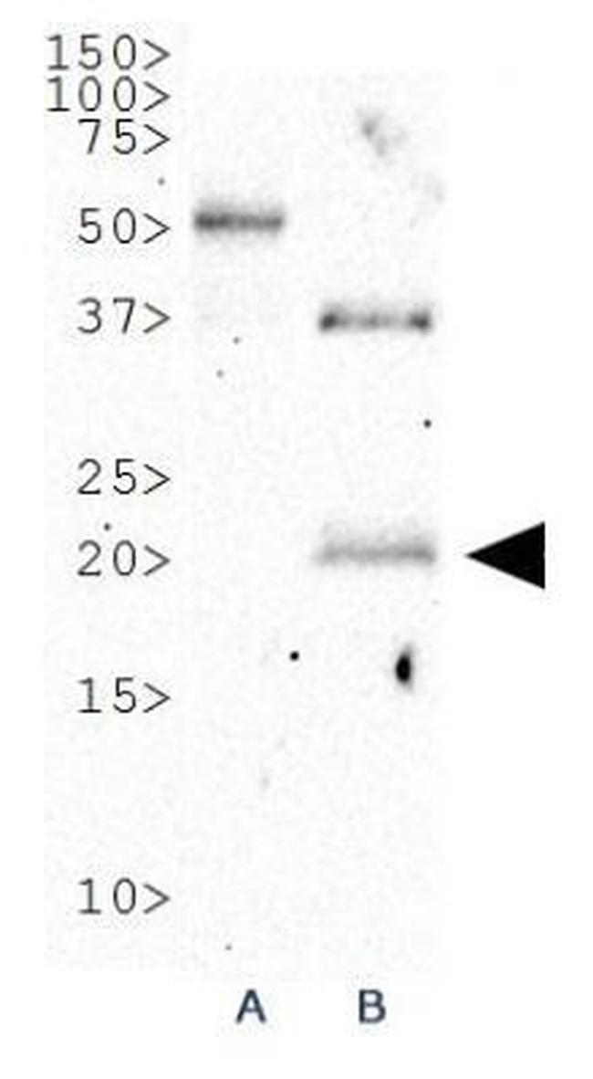 p19ARF Antibody in Western Blot (WB)