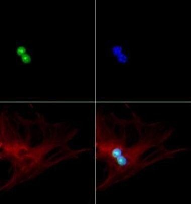 p19ARF Antibody in Immunocytochemistry (ICC/IF)