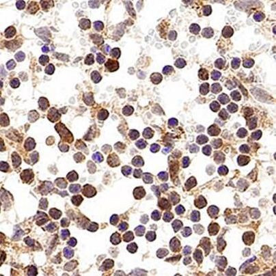 p19ARF Antibody in Immunohistochemistry (Paraffin) (IHC (P))