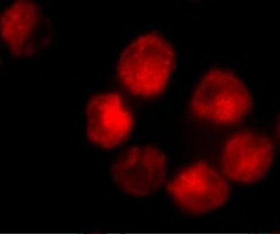 ADAM10 Antibody in Immunocytochemistry (ICC/IF)