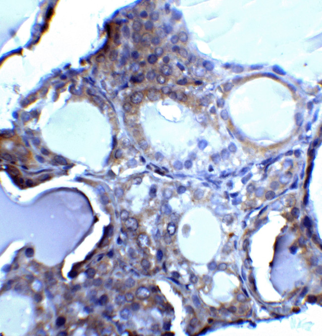 DNase II Antibody in Immunohistochemistry (Paraffin) (IHC (P))