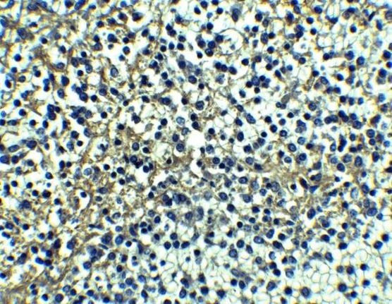 DR4 Antibody in Immunohistochemistry (Paraffin) (IHC (P))