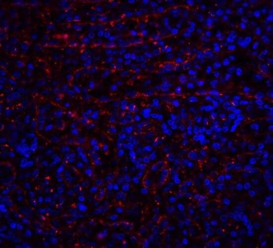 DR4 Antibody in Immunohistochemistry (Paraffin) (IHC (P))