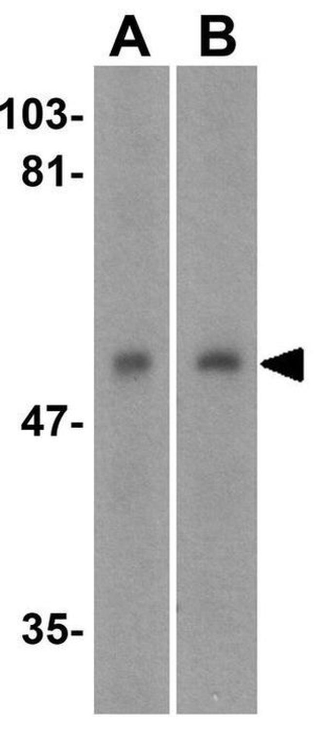 DR4 Antibody in Western Blot (WB)