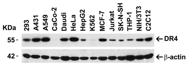 DR4 Antibody in Western Blot (WB)