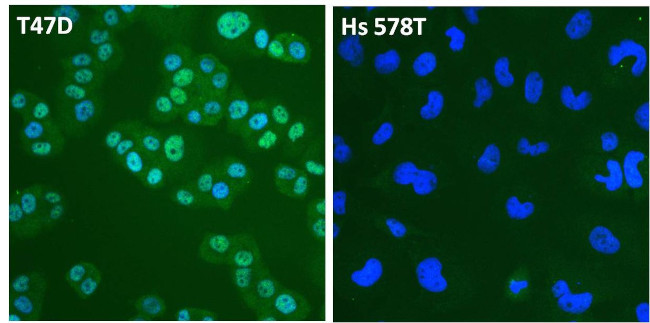 Estrogen Receptor alpha Antibody