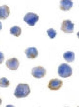 FLIP Antibody in Immunocytochemistry (ICC/IF)