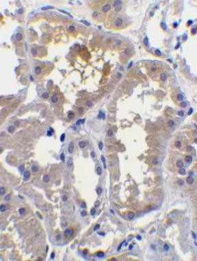 RAIDD Antibody in Immunohistochemistry (Paraffin) (IHC (P))