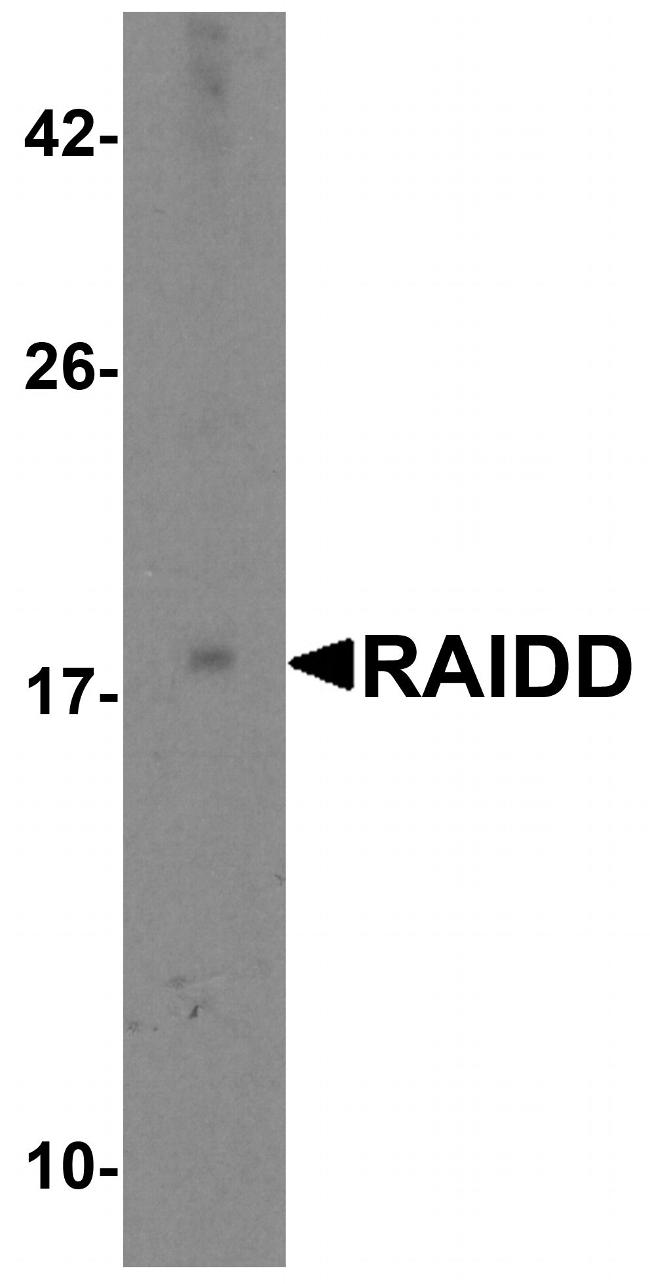 RAIDD Antibody in Western Blot (WB)