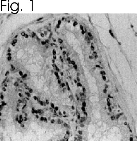 Estrogen Receptor alpha Antibody in Immunohistochemistry (IHC)