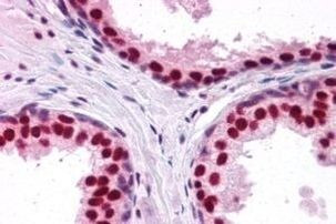 DDX5 Antibody in Immunohistochemistry (Paraffin) (IHC (P))