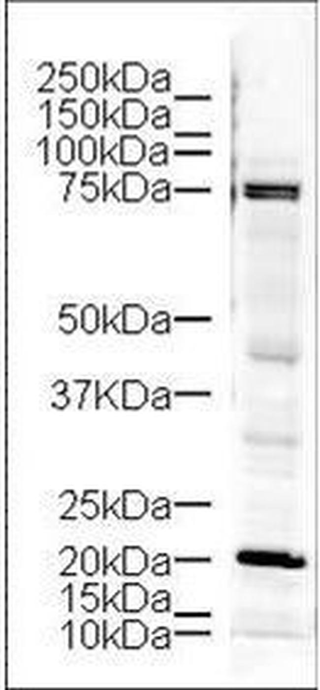 LIMK1 Antibody in Western Blot (WB)