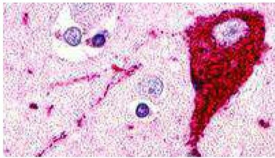 GPR173 Antibody in Immunohistochemistry (Paraffin) (IHC (P))