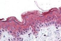 ADAM17 Antibody in Immunohistochemistry (Paraffin) (IHC (P))