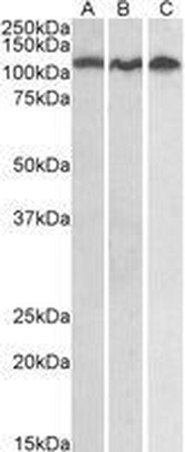 ADAM17 Antibody in Western Blot (WB)